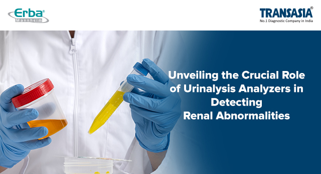 Role of urine analyzers in detecting kidney diseases
